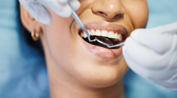 Best Emergency Treatment for Dental Infections or Abscesses in Navarre, OH